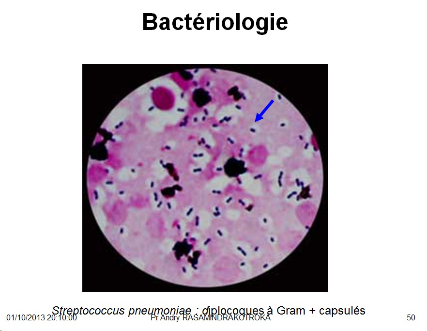 Famille des Streptococcacea et infections correspondantes 2