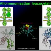 Images sélectionnées alloimmunisations foetomaternelles2
