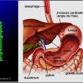 Images sélectionnées Antiulcéreux gastroduodénaux3