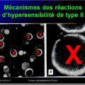 Images sélectionnées réactions d'hypersensibilité7