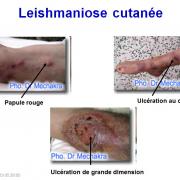Leishmania et leishmaniose 6