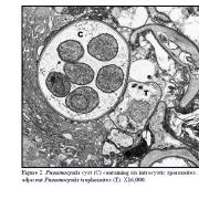 Pneumocystis et pneumocystose 2