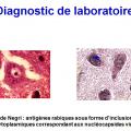 Rhabdoviridae - virus de la rage (8)