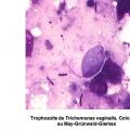 Trichomonas vaginalis et trichomonose (2)