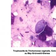 Trichomonas vaginalis et trichomonose (2)