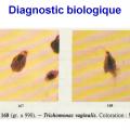 Trichomonas vaginalis et trichomonose (5)